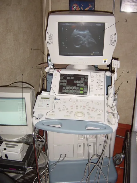 Ecógrafo Toshiba Aplio